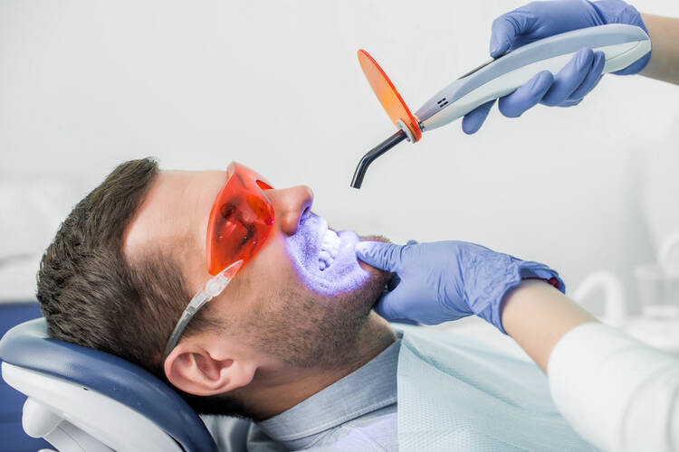 4 Profitable Teeth Whitening Business ideas You Can Start With Little Money