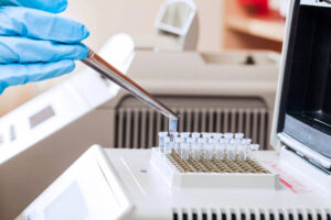How to Start a DNA Testing Business - ProfitableVenture